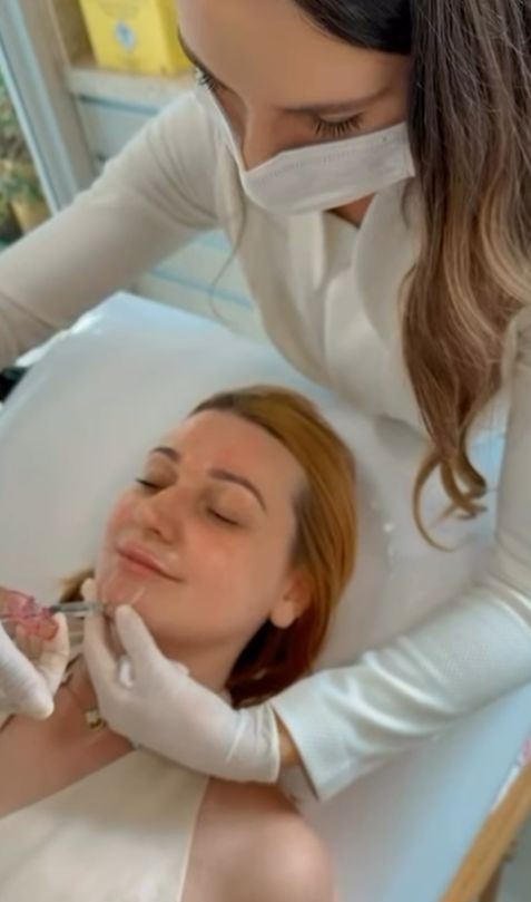 Procedimento de preenchimento facial