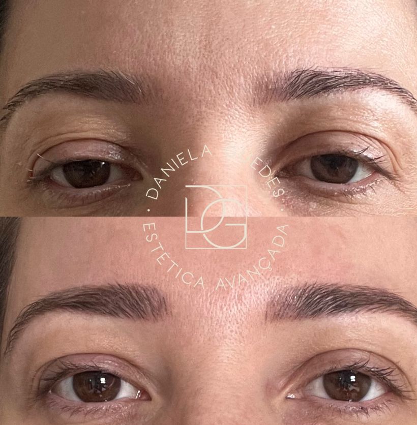 Antes e depois de sobrancelhas